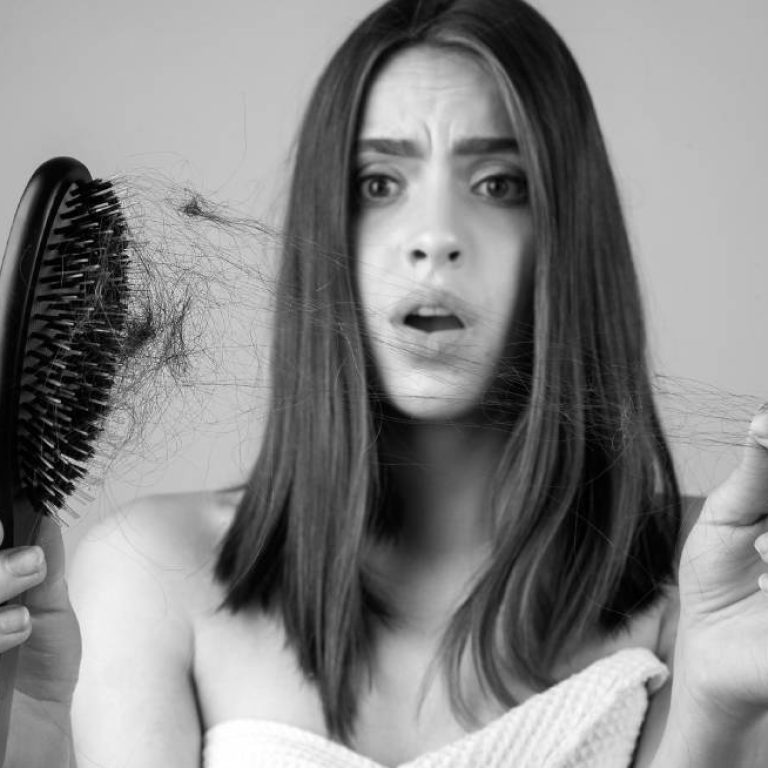 Does High Testosterone Cause Hair Loss in Females?